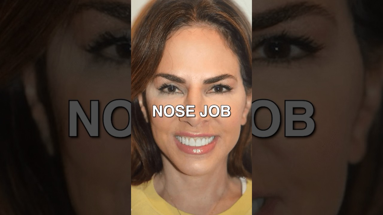 Is plastic surgery worth it? Bravo RHONJ JenFessler UnpolishedGems