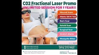 C02 Fractional Laser for scars, Stretch marks, Keloids, Warts, Misquito bites.