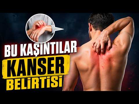 Bu Kaşıntı Kanser Belirtisi!