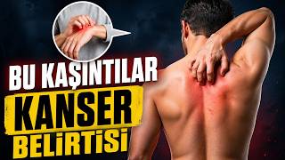 Bu Kaşıntı Kanser Belirtisi!
