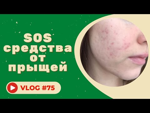 SOS средства от прыщей из аптеки и косметологии