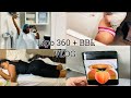 NEW BODY WHO THIS??? | BBL SURGERY VLOG | MIA AESTHETICS | KeepingUpWithShay