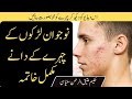 How To Remove Pimples Overnight | Acne Treatment | Pimple Khatam Karne Ka Tarika | hikmat health 313