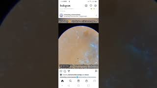 HOT DOG UNDER A MICROSCOPE 1MIN VIDEO SO IT SINKS IN