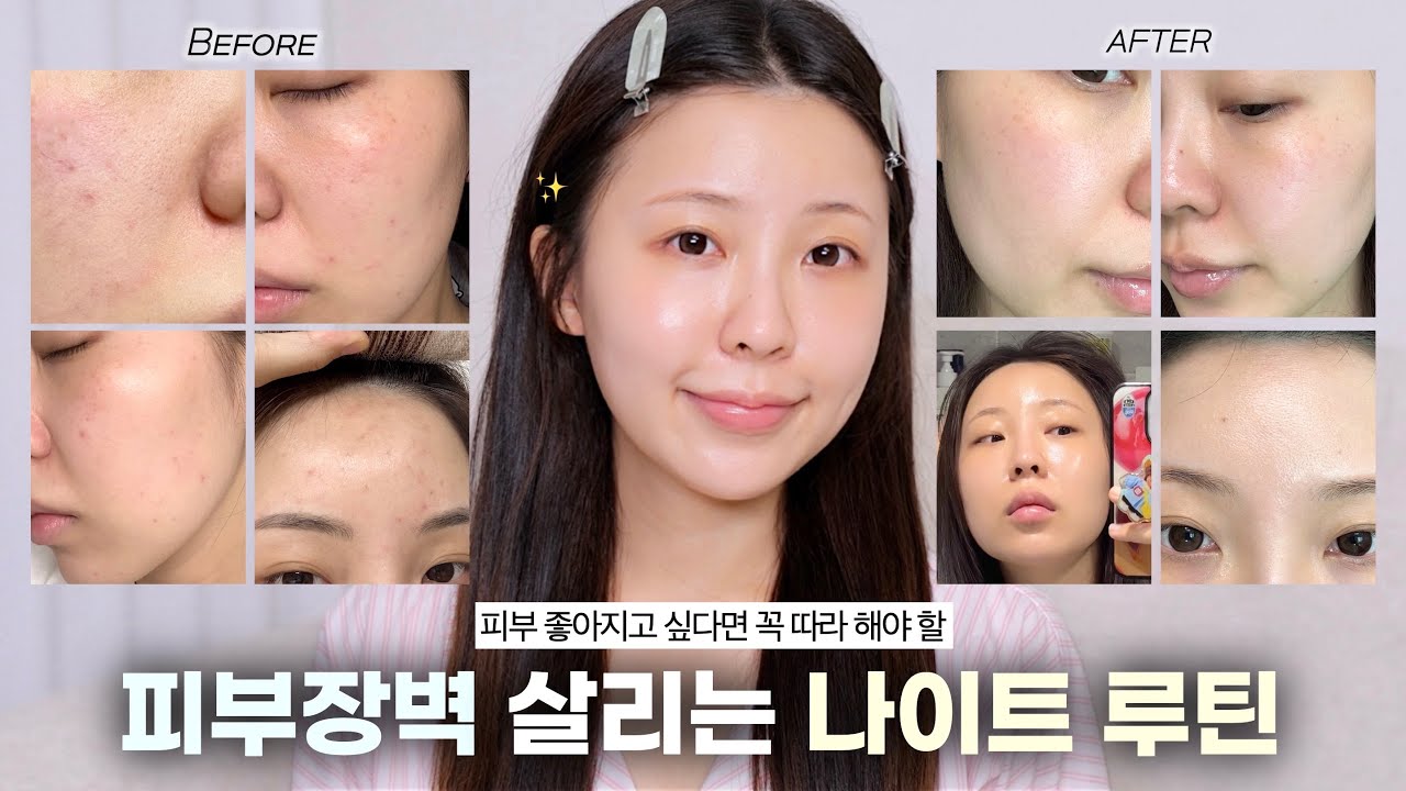 피부 안좋다면 이렇게 해보세요🙏🏻직접 써보고 정착한 클렌징&장벽 케어 루틴✨(장벽케어 클렌저•쿨링진정 토너패드•장벽앰플•레티놀광채세럼•장벽크림) 스킨케어 추천 / 윤이든