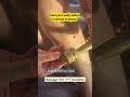 Stomach acting up from stress? Try this TCM technique.
