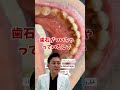 下の歯の裏側は汚れが溜まりやすいんです💦#歯石 #歯列矯正 #蒲田 #歯医者 #矯正