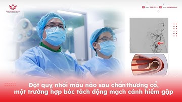 Đột quỵ nhồi máu não sau chấn thương cổ , một trường hợp bóc tách động mạch cảnh hiếm gặp