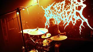 .357 HOMICIDE - PUS TRANSFUSION [OFFICIAL MUSIC VIDEO] (2026) SW EXCLUSIVE