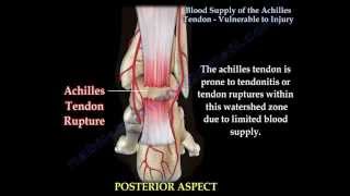 Achilles Tendon rupture , Vulnerablity to  Injury - Everything You Need To Know - Dr. Nabil Ebraheim