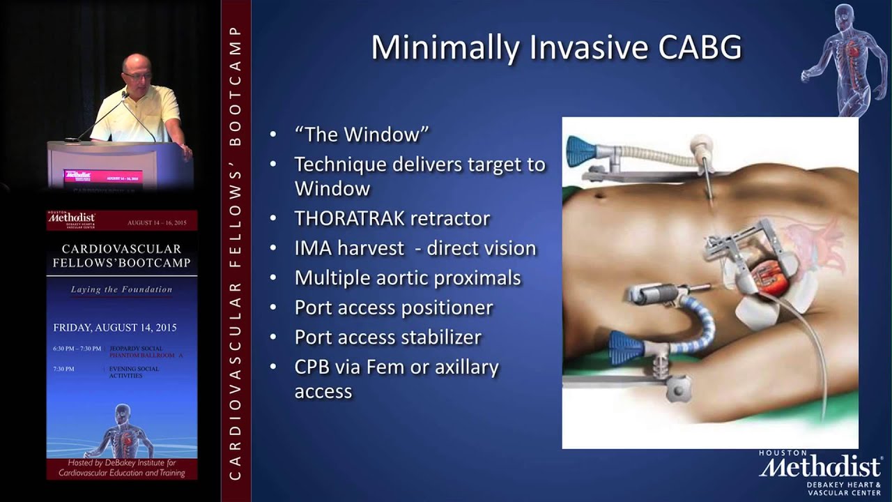 Coronary Artery Bypass (Mahesh Ramchandani, MD) major field of study medicine