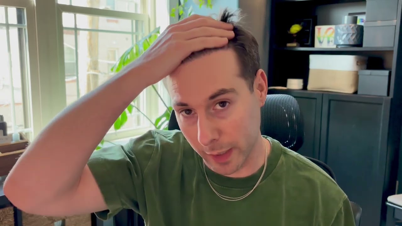 FOUR MONTHS! post hair transplant at the Cosmedica Clinic in Istanbul with Dr. Acar