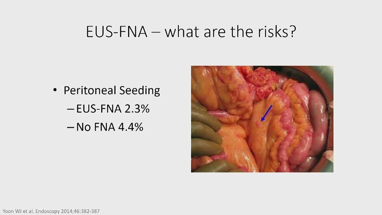 Bread and Butter EUS  The Pancreas   Digestive Disease Week