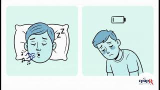 Vblog:Deviated Septum Self Test: 5 Signs to Check at Home (2026) #sleepapnea