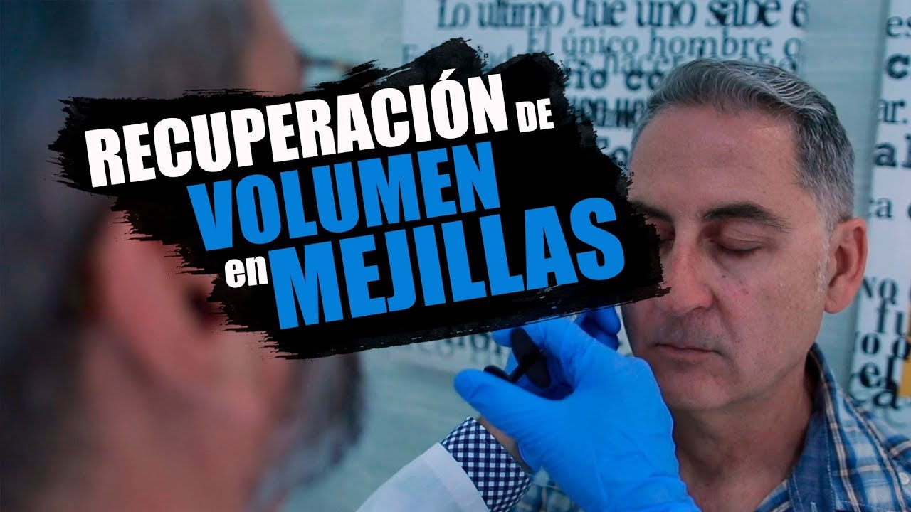 Recuperar VOLUMEN EN MEJILLAS con inductor de colágeno