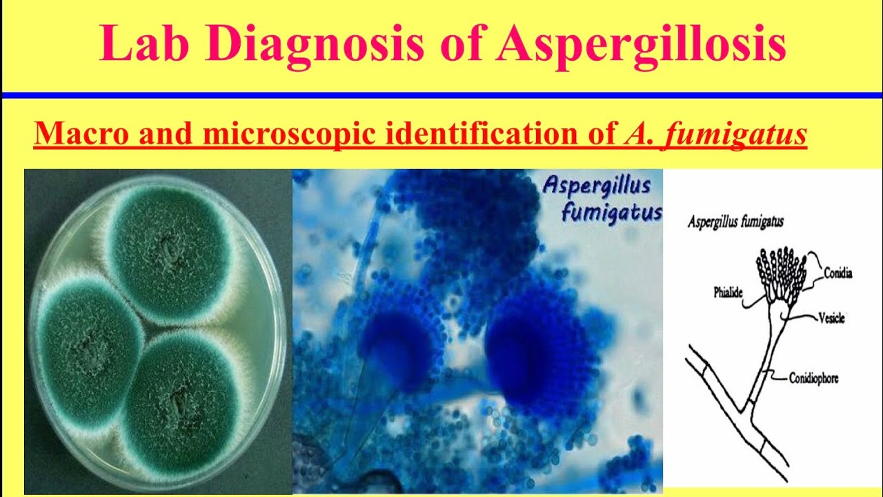 تشخيص الامراض الفطرية فى الدواجن (1) (مرض الاسبرجلس) Diagnosis of Fungal Diseases (Aspergillosis)