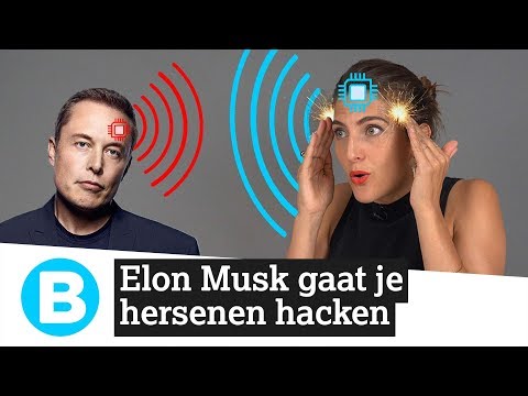 Hersenen hacken: is Elon Musk wel goed bij zijn hoofd?