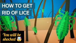 Why Lice Are So Hard To Kill?
