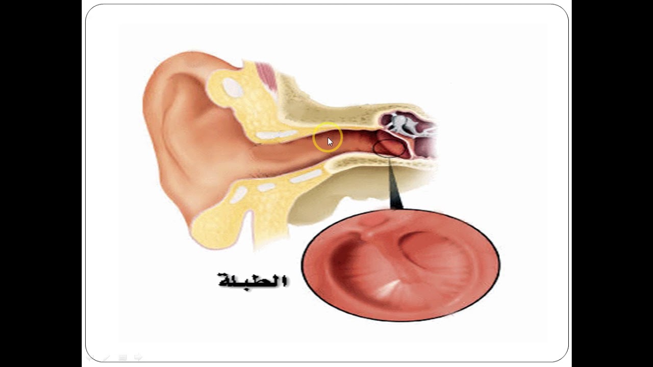 المحاضرة الاولى اونلاين - مقرر اضطرابات التواصل - الدبلوم المهني