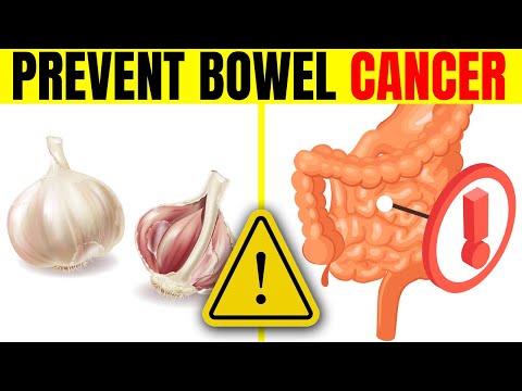 10 Foods To Prevent COLON POLYPS & BOWEL CANCER