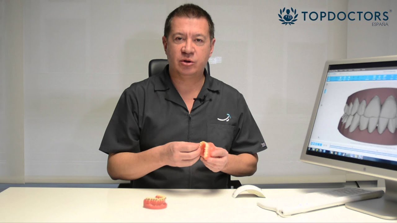 Ortodoncia invisible - Cuidados durante y después del tratamiento top movies on netflix