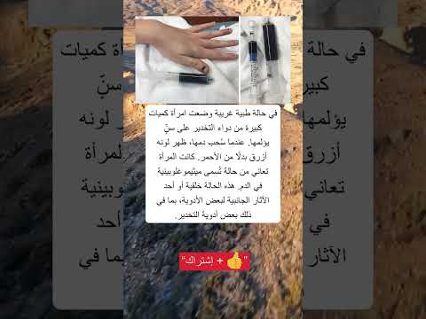 حالة طبية نادرة من غرائب البشر لم يكن ليصدقها أحد غرائب