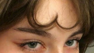 ღ Your Forehead Is So Flat Forehead Reshaping Procedure