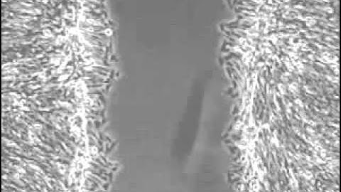 Wound Repair and Fibroblast Migration