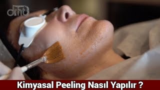 Kimyasal Peeling Uygulaması