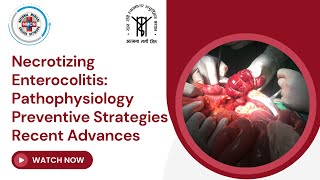 Necrotizing Enterocolitis : Pathophysiology Preventive Strategies Recent Advances