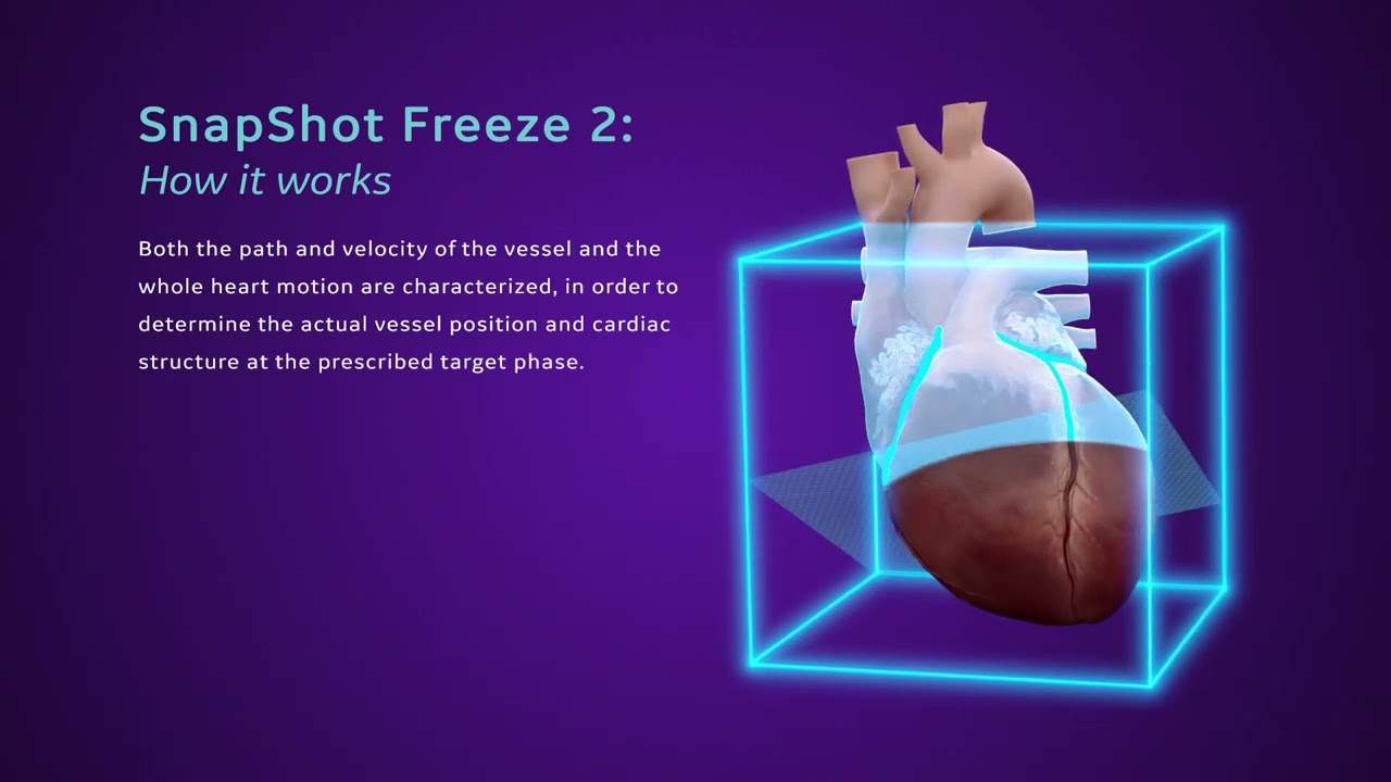 SnapShot Freeze 2 Explainer video