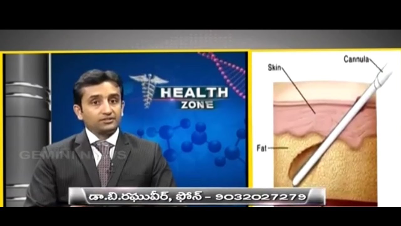 Dr Raghuveera Reddy Dr.Raghuveer Reddy explains about Liposuction and Body Sculpturing ...