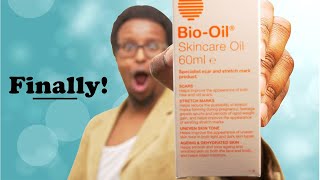 Bio-oil Review | what i found after trying it for 2 weeks