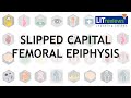 Slipped Capital Femoral Epiphysis