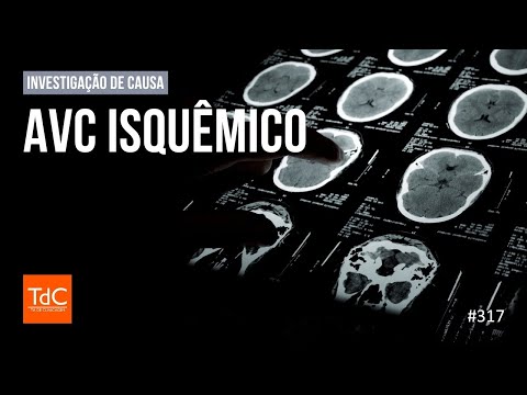 Thumbnail - Episodio 317: AVC isquêmico - Investigação de causa