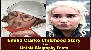 Emilia Clarke Childhood Story Plus Untold Biography Facts Content