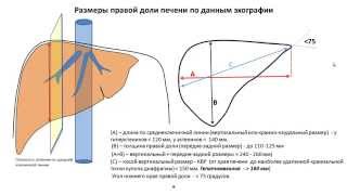 Антибактериальное лечение гепатита в