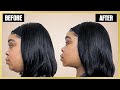 LOSE DOUBLE CHIN FAST| I lost my DOUBLE CHIN in days by doing this | How to get rid of DOUBLE CHIN