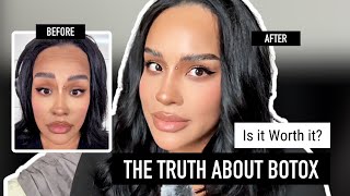 The Truth About Botox | Is it Worth it?