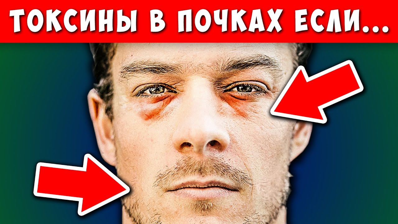 10 Признаков того, что Ваши ПОЧКИ задыхаются от Токсинов! - YouTube