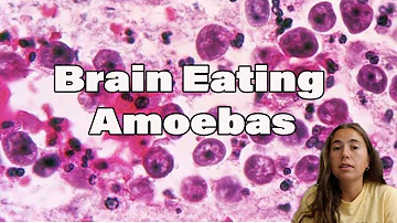 Brain-Eating Amoebas