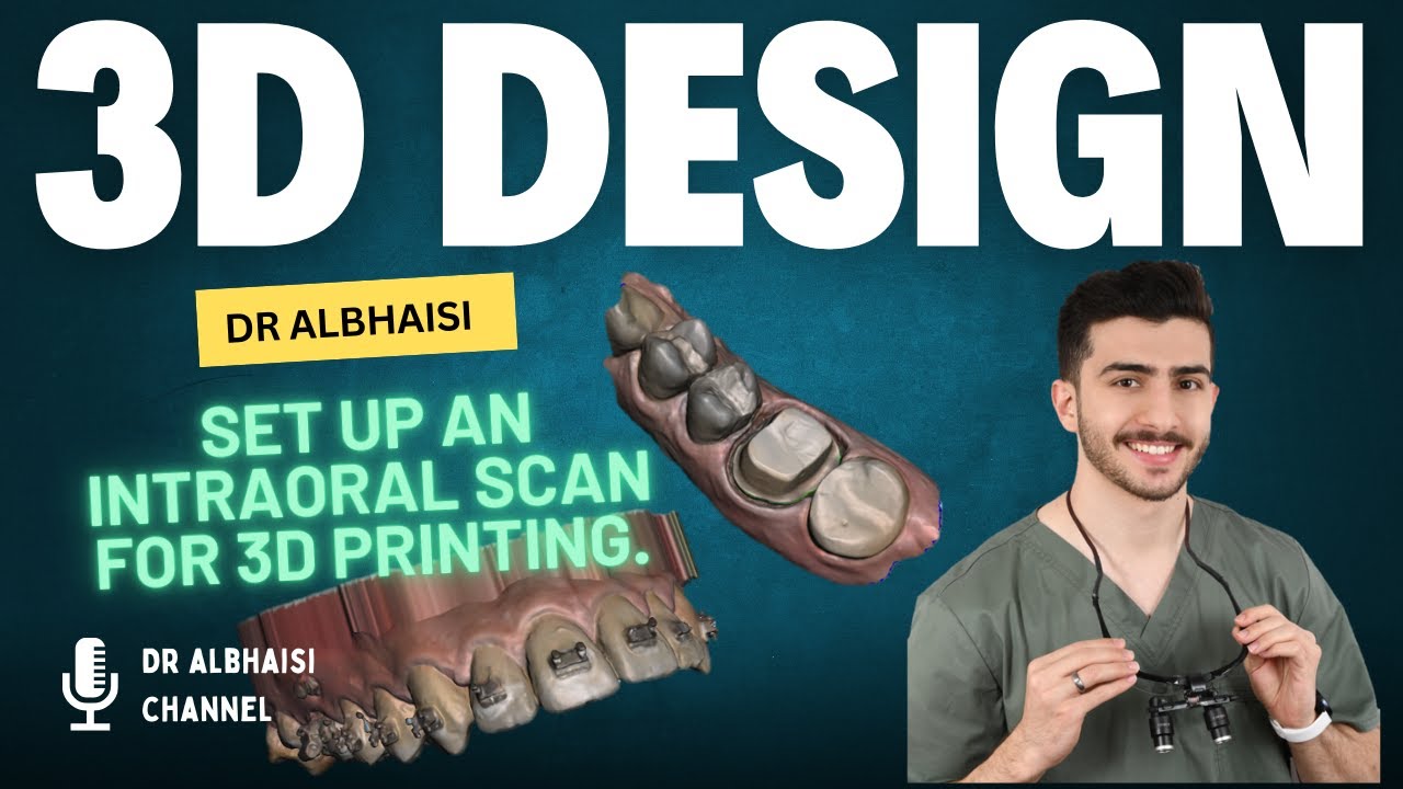 Set Up an intra-oral scan for 3D printing - YouTube