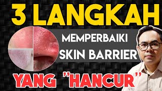 Cara Alami Mengatasi Kulit Iritasi Akibat Skincare | Kulit Perih, Merah dan Mengelupas