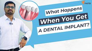 Dental Implant Process Explained by Dr. Pawan Sawalakhe.