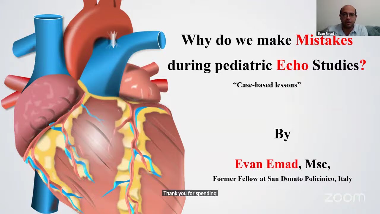 Why do we make mistakes in pediatric echo studies ?