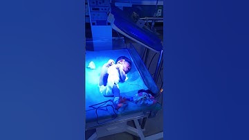 phototherapy for neonatal jaundice