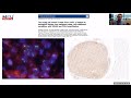 Dr. Sambit Mohanty Memorial Series "Sex cord stromal Tumours of Testis"  by Dr. Andres Martin Acosta