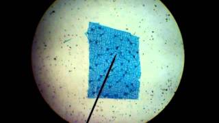 LEAF EPIDERMIS WITH STOMA AND GUARD CELLS