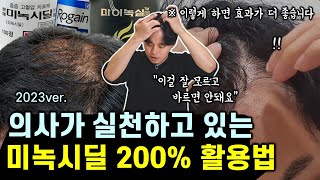 (2023ver.) 탈모인 대부분이 잘 모르는 미녹시딜 효과 높이는 꿀팁 7가지