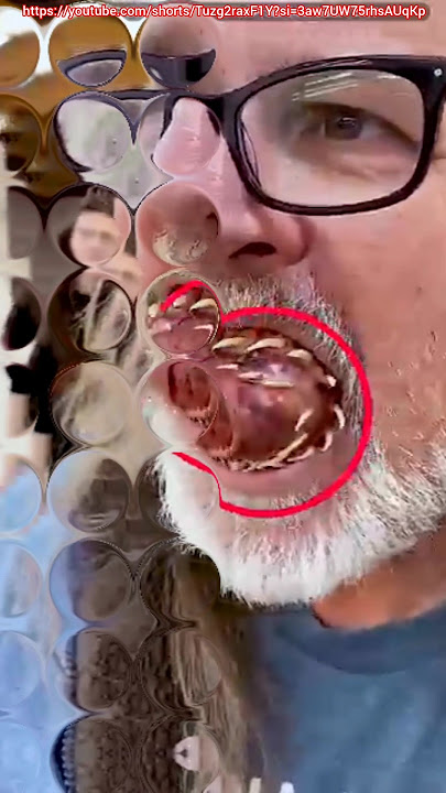 https://youtube.com/shorts/Tuzg2raxF1Y?si=3aw7UW75rhsAUqKp
